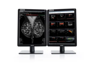 Breast Imaging Displays
