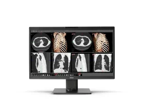 Radiology Displays